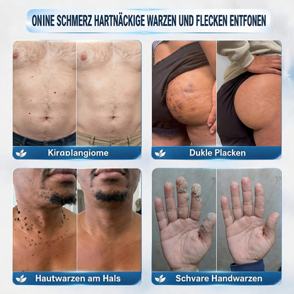 🎁🎁🎁 Sichern Sie sich 50 % Rabatt beim Kauf eines zweiten Produkts!